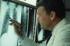 Radiologist examining a chest x-ray